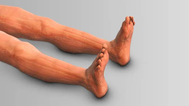 Limb Deformities image 1