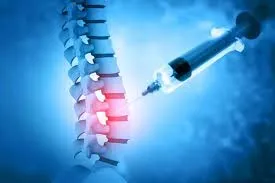 Spinal Injections for Back & Neck Pain Relief image 1