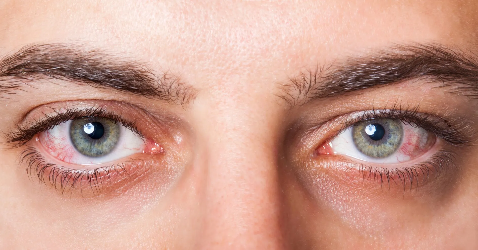 Dry Eye Treatment in Thane image 1