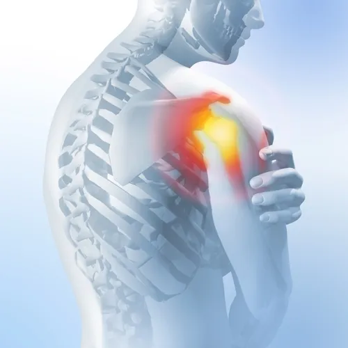 Shoulder Pain Treatment image 1