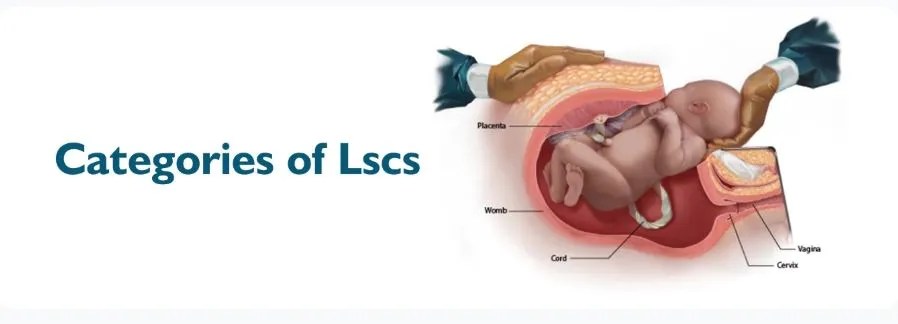 L.S.C.S Delievary  image 1