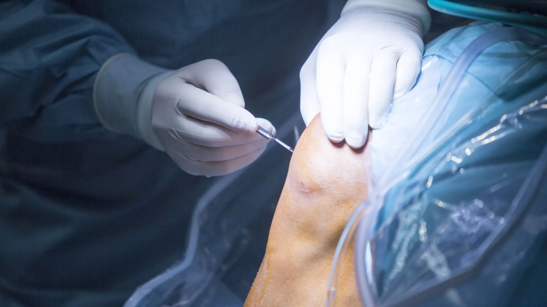 Accident and Trauma Surgery image 1