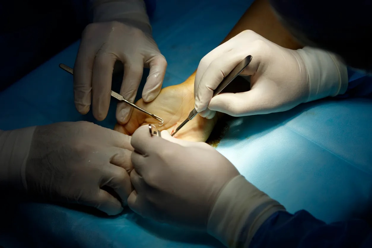 Hand Surgery Specialist image 1