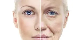 Anti-Ageing Treatment image 1