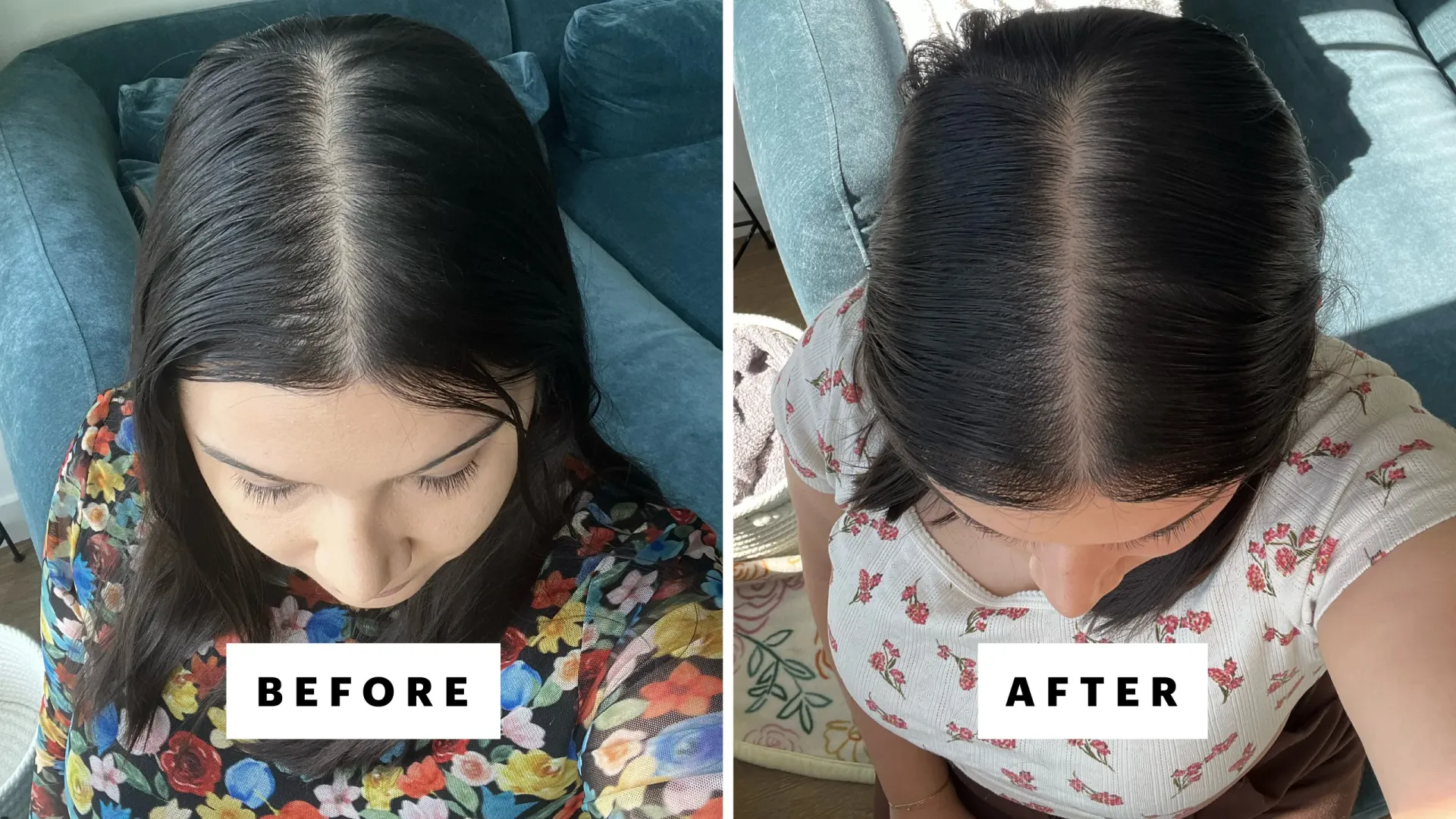 Hair Regrowth Treatment image 1