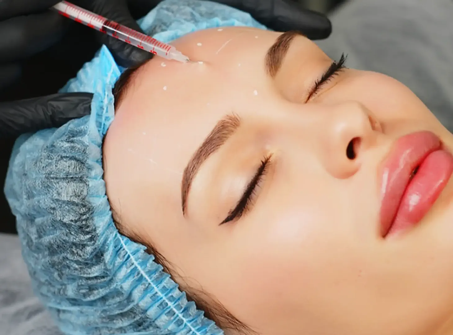 Botox & Fillers Treatment image 1