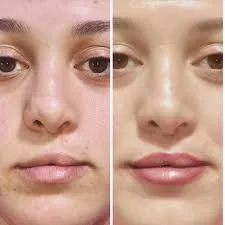 Medical Micropigmentation image 1