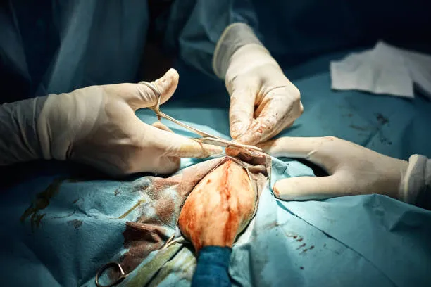 Perineal Repair image 1