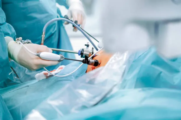 Laparoscopy image 1