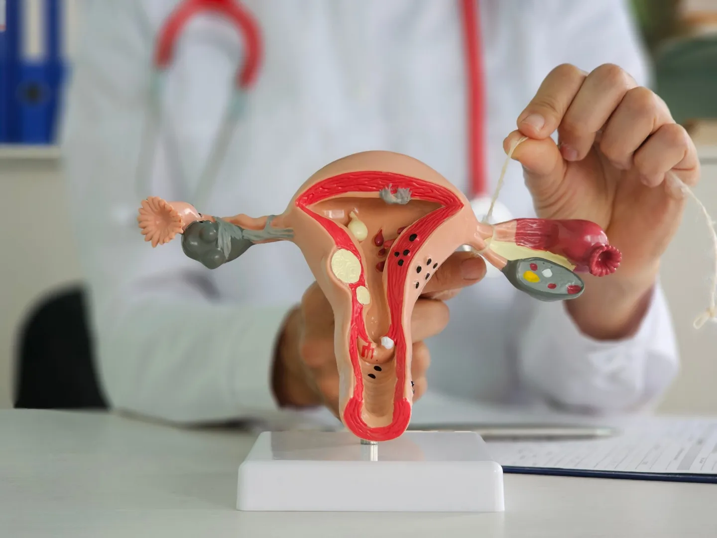 Permanent Sterilization image 1