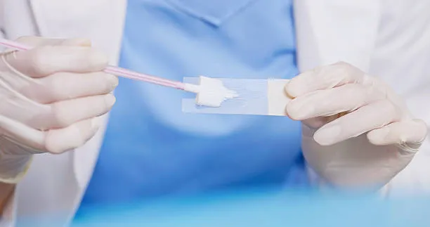Pap smear image 1