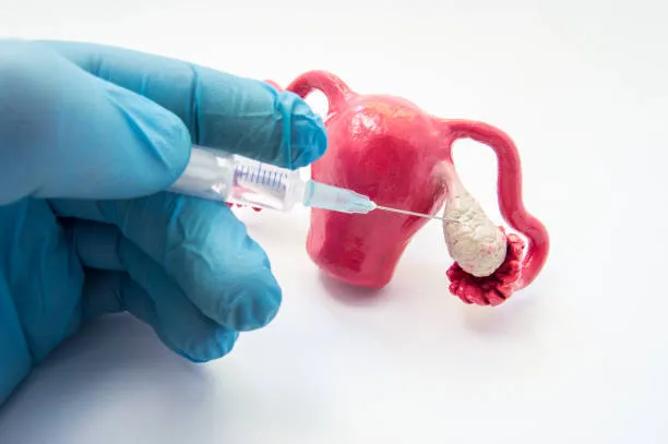Ovulation induction image 1