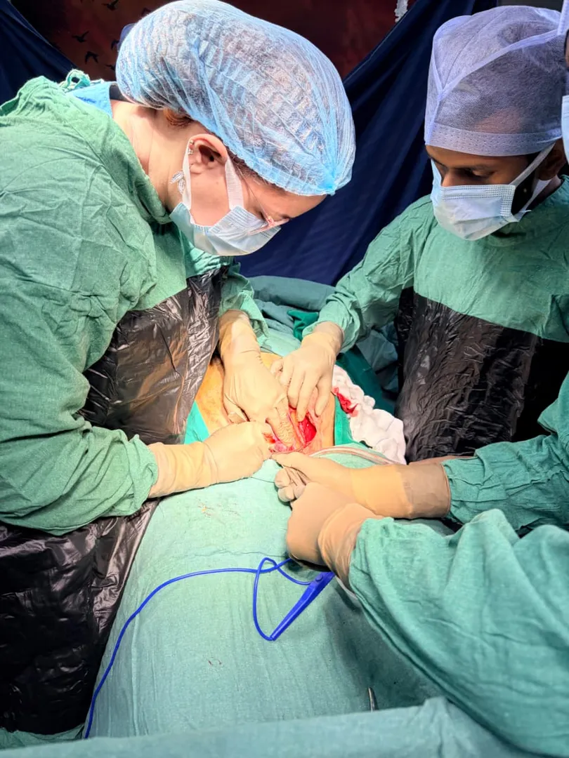 Cesarean section (C-section) image 1