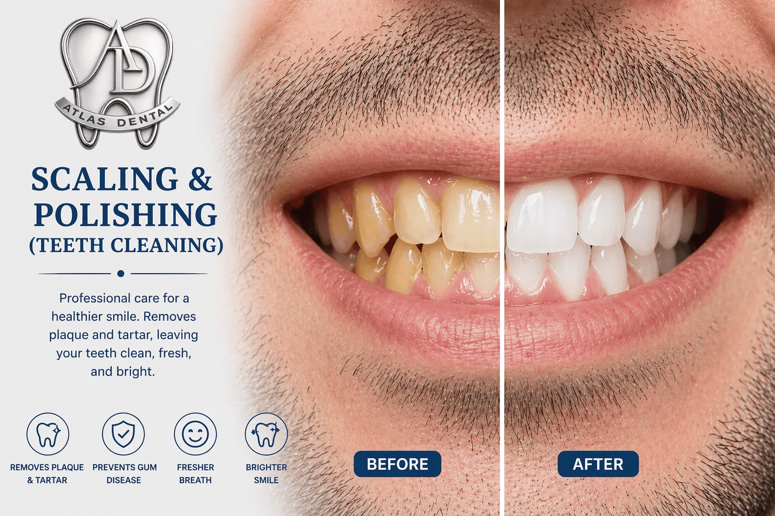 Scaling & Polishing image 1