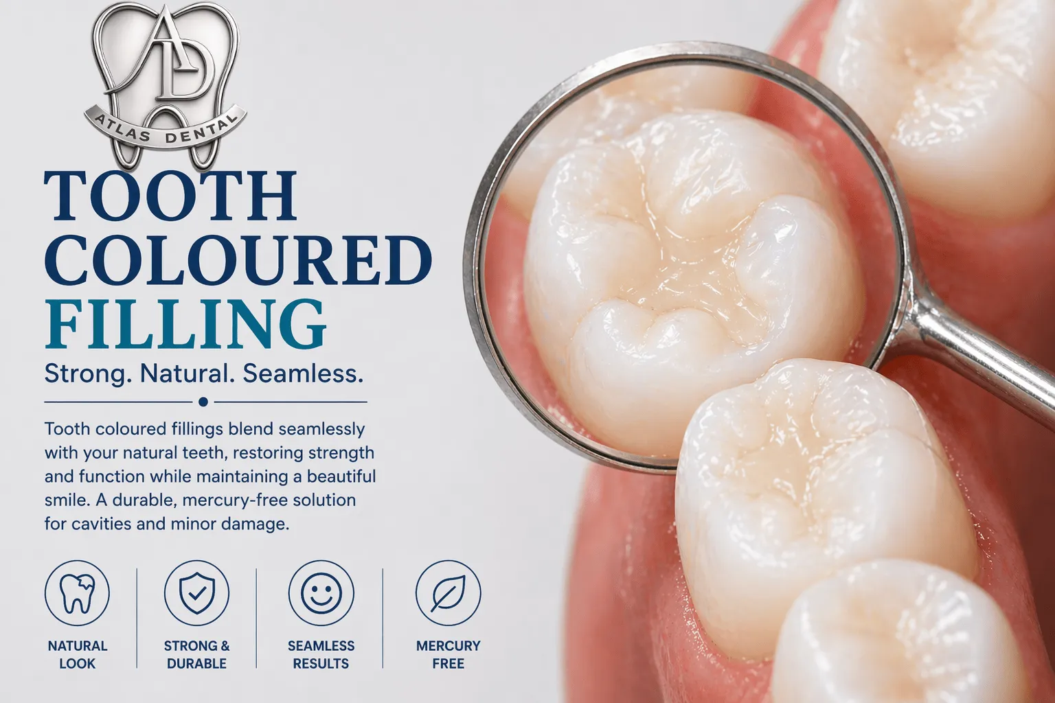 Tooth-Coloured Filling image 1