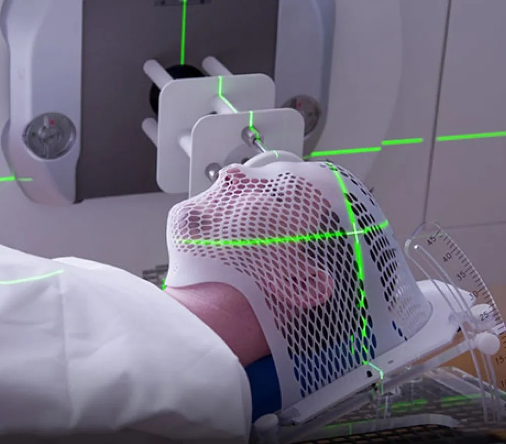 Stereotactic Radiosurgery ( SRS) image 1