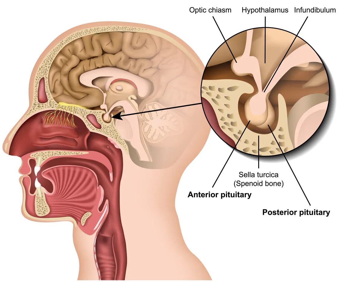 Transsphenoidal Surgery  image 1
