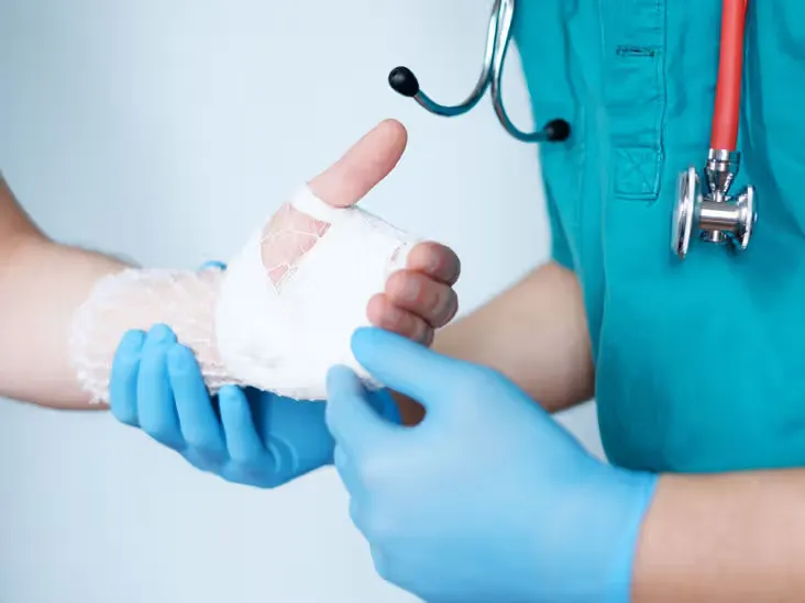 Ganglion Cyst Removal image 1