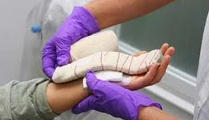  Carpal Tunnel Release image 1