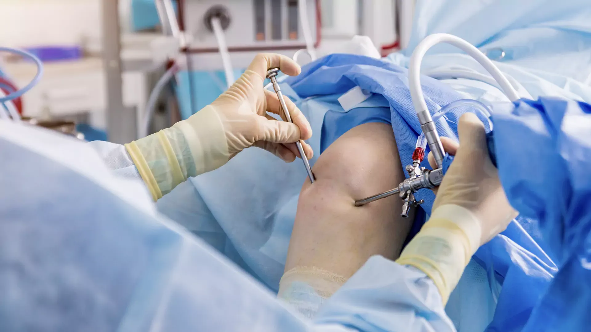 Arthroscopy image 1