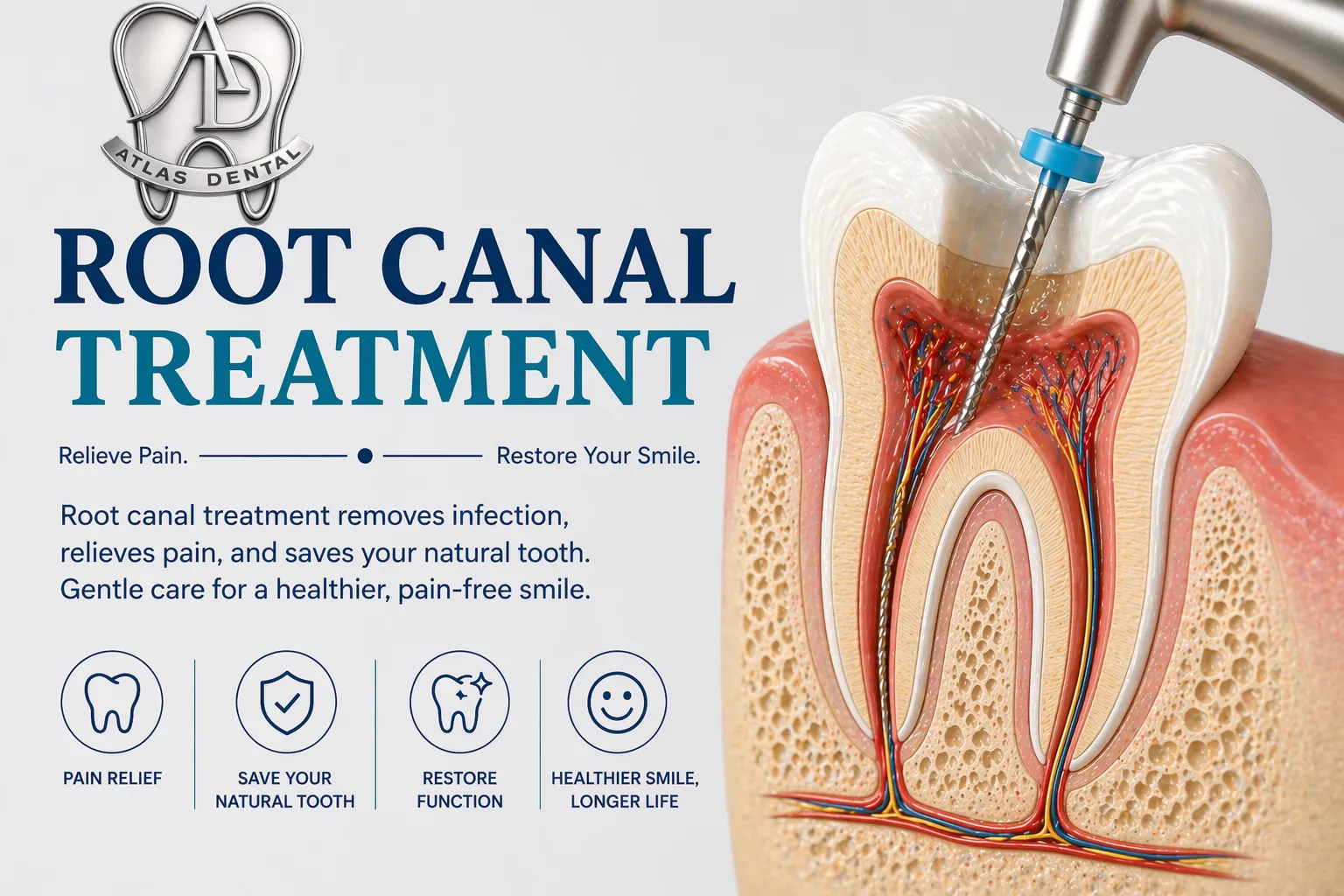 Root Canal Treatment image 1
