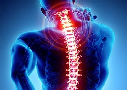 Spine Surgery image 1
