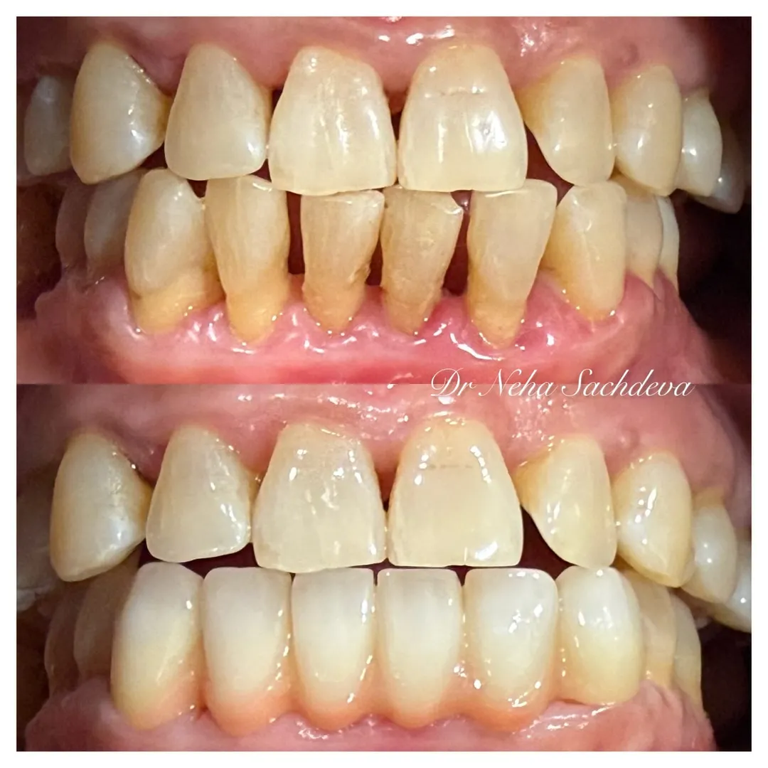Prosthodontics image 2