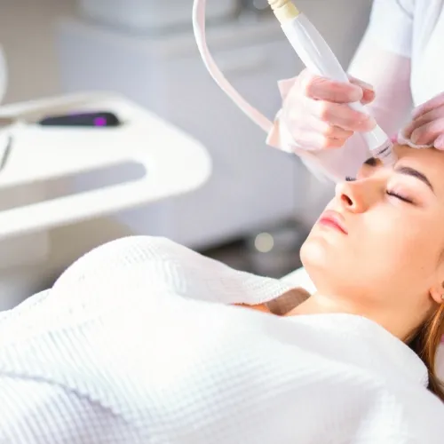 Laser Facial image 1
