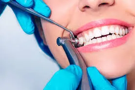 Cleaning and Polishing Treatment image 1