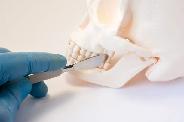 Orthognathic or Corrective Jaw Surgery image 1