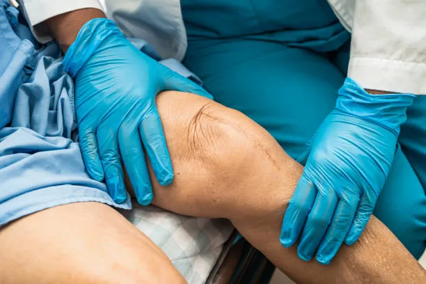 Joint Replacement Surgery image 1