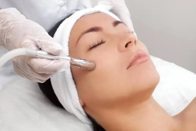 Microdermabrasion image 1