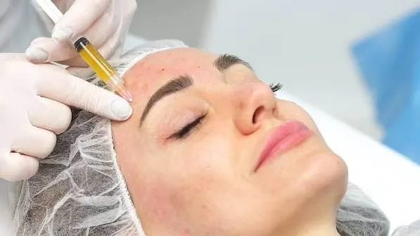 PRP skin rejuvenation image 1