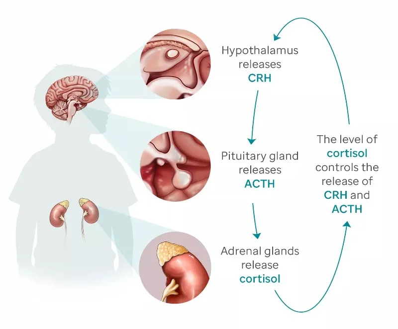 Adrenal & Pituitary Gland Disorders image 1
