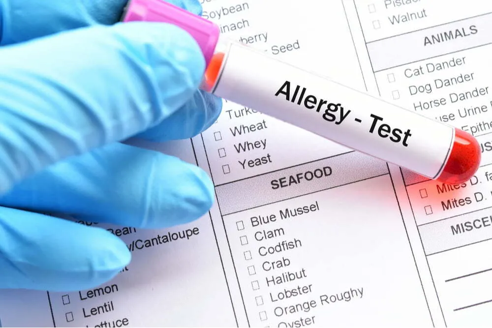 Allergy Testing image 1