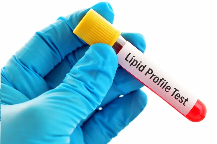 Lipid Profile & Cholesterol Testing image 1