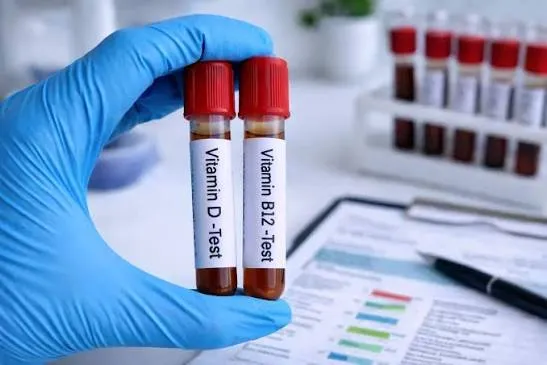 Vitamin & Nutritional Deficiency Test image 1