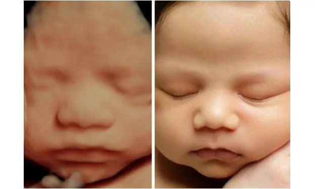 4D Ultrasound image 1