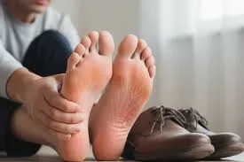 Peripheral Neuropathy image 2