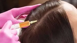 Customized hair restoration plans image 1