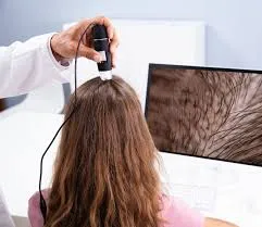 Hair fall evaluation and treatment image 1