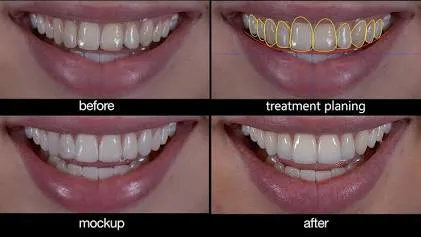 Smile Design image 1