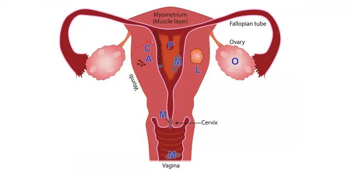 Menstrual Disorders Management image 1