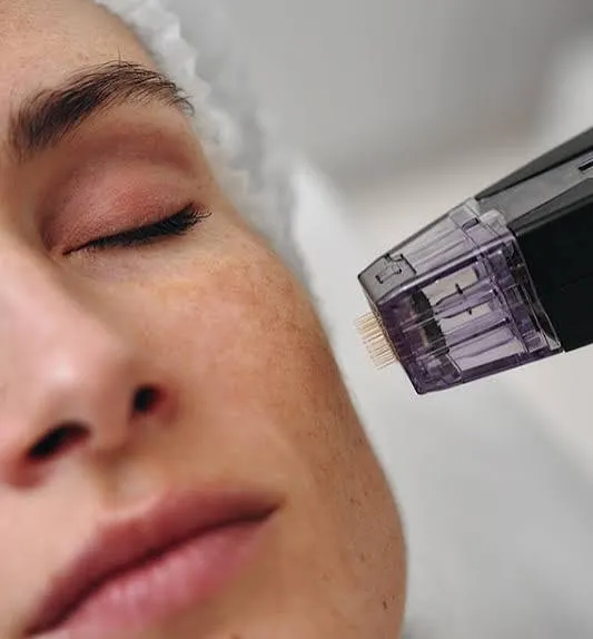 morpheus8 Treatment  image 1