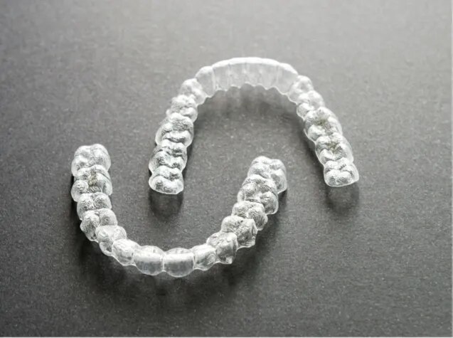 Teeth Alignment Treatment for a Healthy, Confident Smile image 1