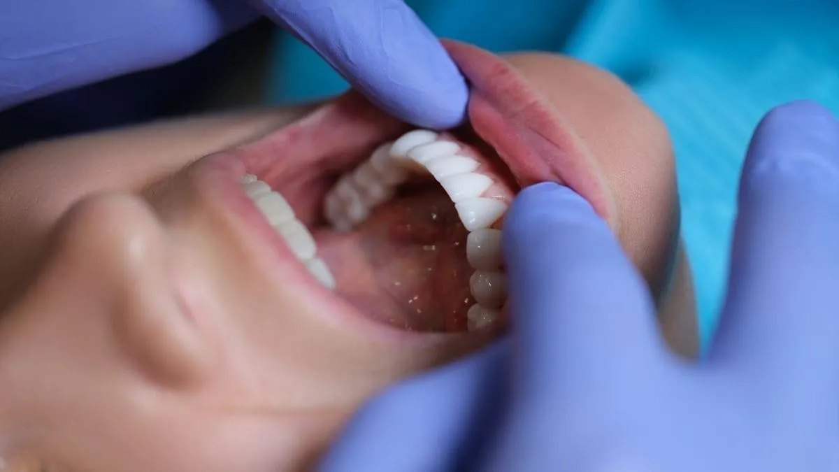 Dental Crowns & Bridges image 1