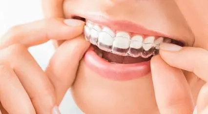 Invisible Braces image 1