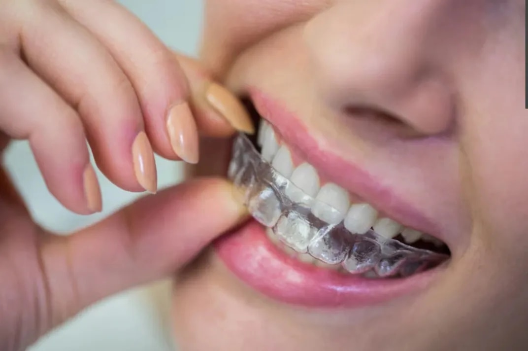 Orthodontics & Clear Aligners image 1