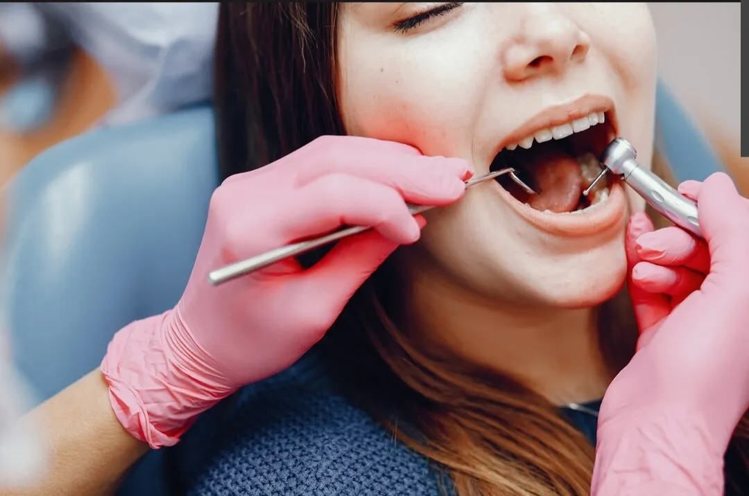 Root Canal Treatment image 1