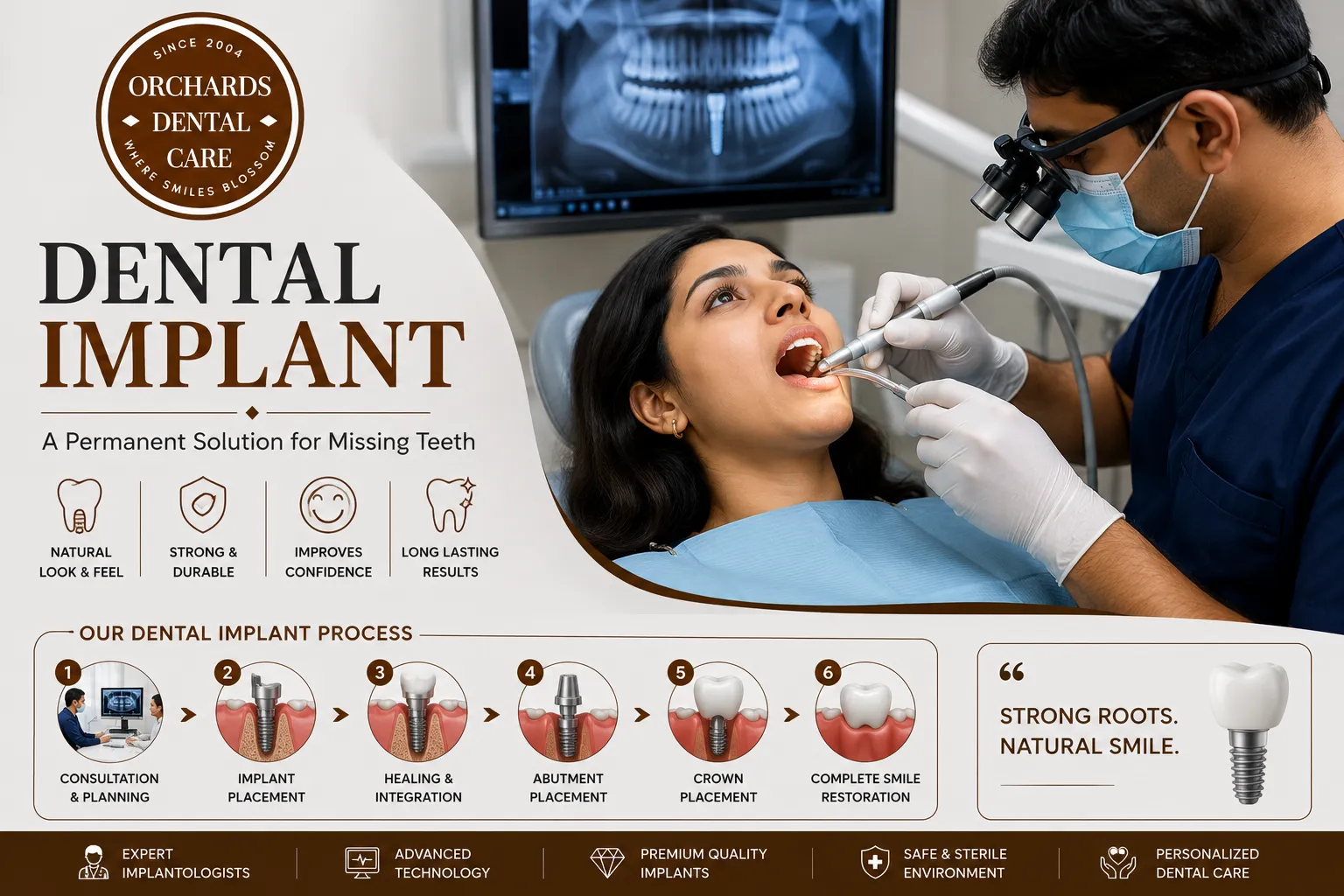 Dental Implants image 1
